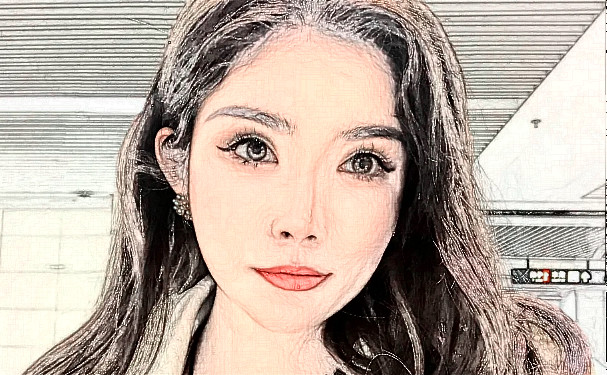 烏魯木齊花之妍醫(yī)療美容整形醫(yī)院脂肪填充三個月術后恢復案例&技術怎么樣?