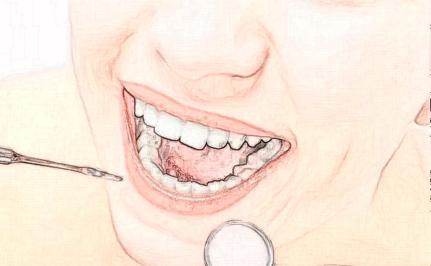 北京天壇醫(yī)院白保晶種植牙技術(shù)優(yōu)勢怎么樣?經(jīng)驗(yàn)案例