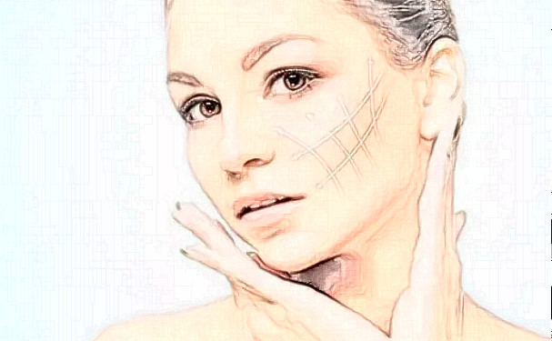 成都藝星謝雯面部提升求美案例&技術(shù)點評