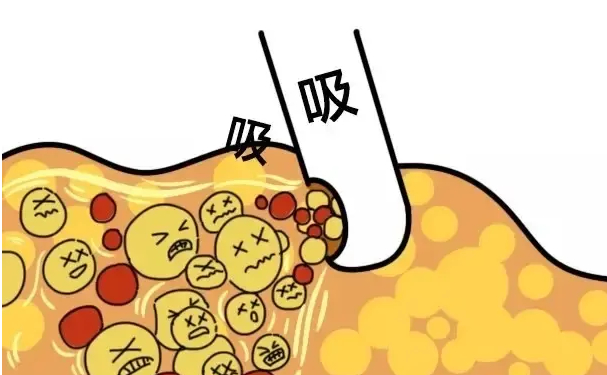 青島市中心醫(yī)院魏述強(qiáng)吸脂減肥技術(shù)怎么樣?醫(yī)生信息