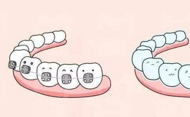 廣元市中心醫(yī)院牙齒歪斜矯正醫(yī)生排名,技術(shù)評測&醫(yī)院優(yōu)勢