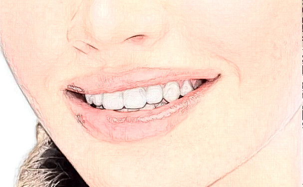 余杭中醫(yī)院滿口牙種植價目一覽表?求美案例,醫(yī)生信息