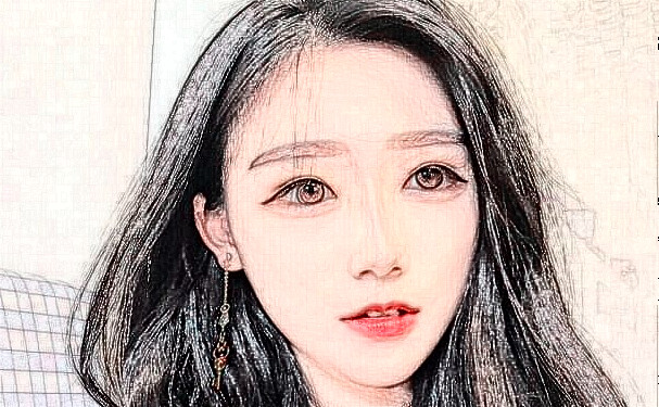 運(yùn)城市中心醫(yī)院岳長(zhǎng)路太陽(yáng)凹陷整形手術(shù)術(shù)后案例&價(jià)格明細(xì)?