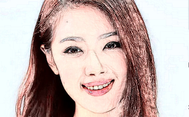 臨沂市人民醫(yī)院李玉柱激光美容祛斑價格明細?術后6個月案例,醫(yī)生介紹