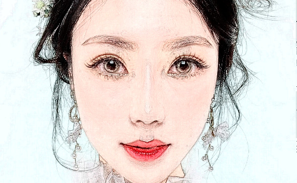 上海市同濟(jì)醫(yī)院鞏倫禮肥胖下頜角整形技術(shù)評價怎么樣?案例盤點&效果詳情