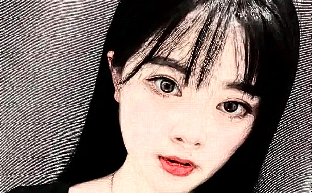 西京醫(yī)院馬顯杰玻尿酸豐唇術(shù)后6個月案例|技術(shù)特色怎么樣?醫(yī)生介紹