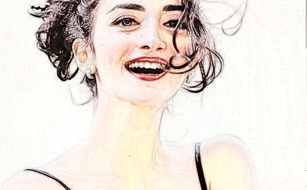 首都醫(yī)科大學(xué)附屬北京世紀(jì)壇醫(yī)院尹宏宇牙齒擁擠矯正技術(shù)怎么樣?多少錢?恢復(fù)案例